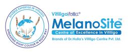 Vitiligo Holla Melanosite